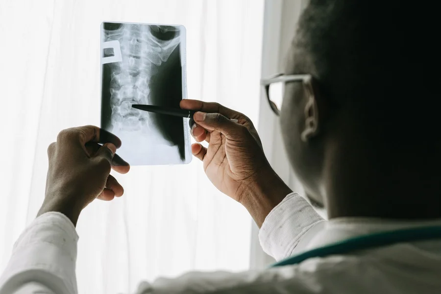 Scoliosis Surgery Cost: Insurance, Out-of-Pocket Fees, and Billing Tips